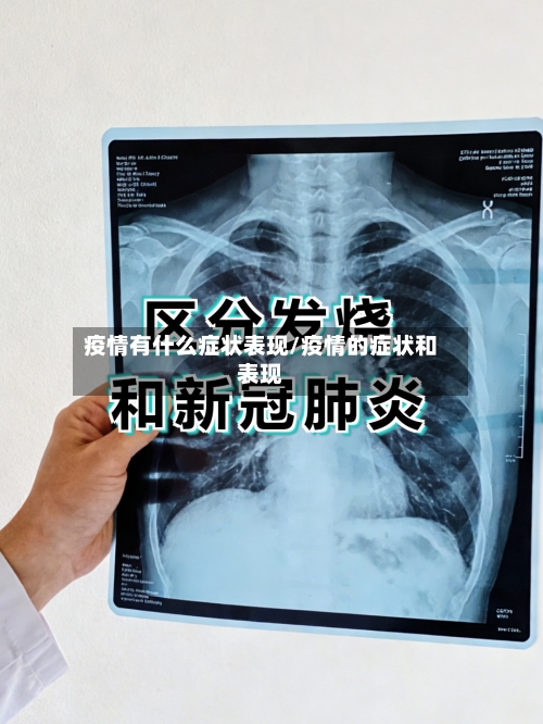 疫情有什么症状表现/疫情的症状和表现-第2张图片