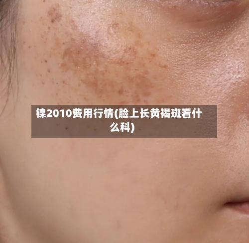 镍2010费用行情(脸上长黄褐斑看什么科)
