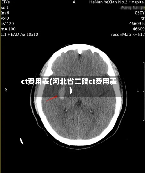 ct费用表(河北省二院ct费用表)-第3张图片